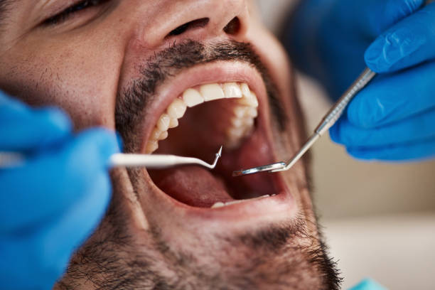 Best Dentist Open Late Near Me  in Jnstown, OH